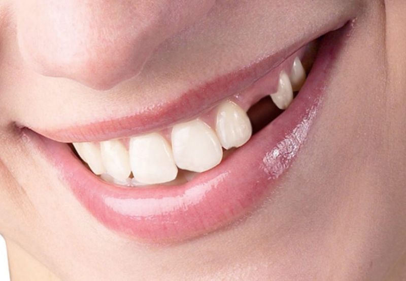 Ngủ mơ thấy rụng răng không chảy máu